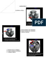 Preguntas Del Segundo Parcial de Neuro