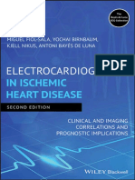 Electrocardiography in Ischemic Heart Disease Clinical and Imaging Correlations and Prognostic Implications