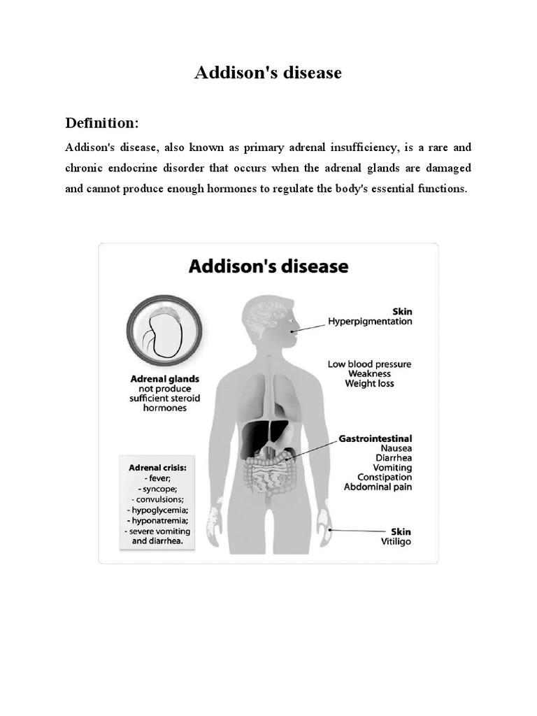 Addison's disease PDF