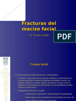 Fracturas_faciales