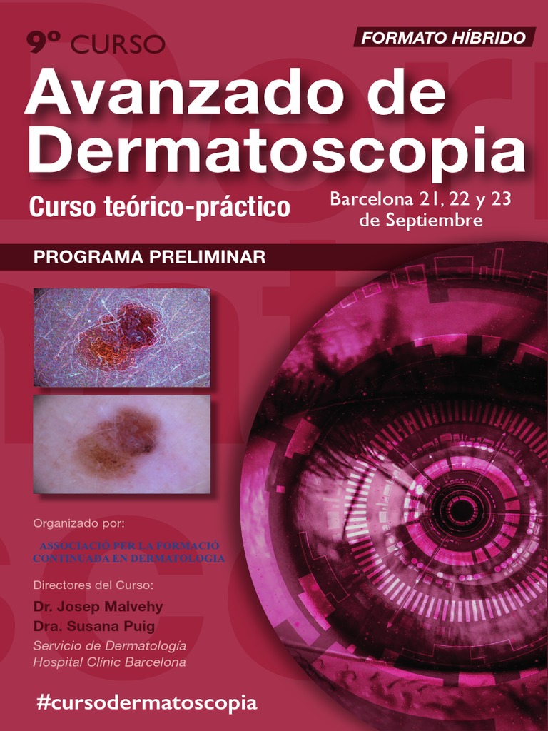 9º Curso Avanzado de Dermatoscopia | PDF | Dermatología | Medicina