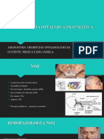 Neuropatía Oftalmica Traumática: Asignatura: Urgencias Oftalmológicas 8vo Docente: Jessica Tapia Varela