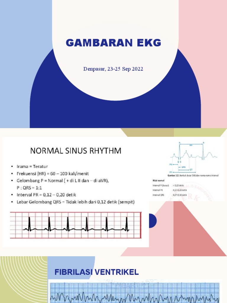 Gambaran Ekg | PDF
