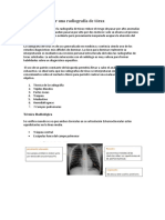 Interpretacion de Una Radiografia de Torax.