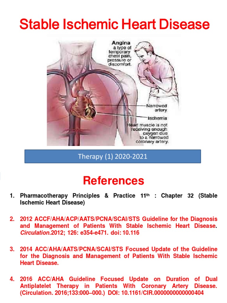 Understanding Stable Ischemic Heart Disease | PDF | Coronary Artery ...