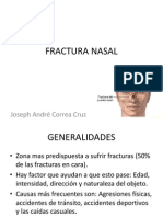 Fractura Nasal