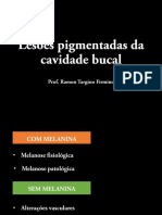 Lesões Pigmentadas Da Cavidade Bucal