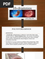 Hydramnios