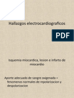 Hallazgos Electrocardiograficos