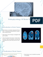 Pathophysiology of Brain Tumors