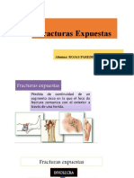 Exposcion de Fractura Expuesta