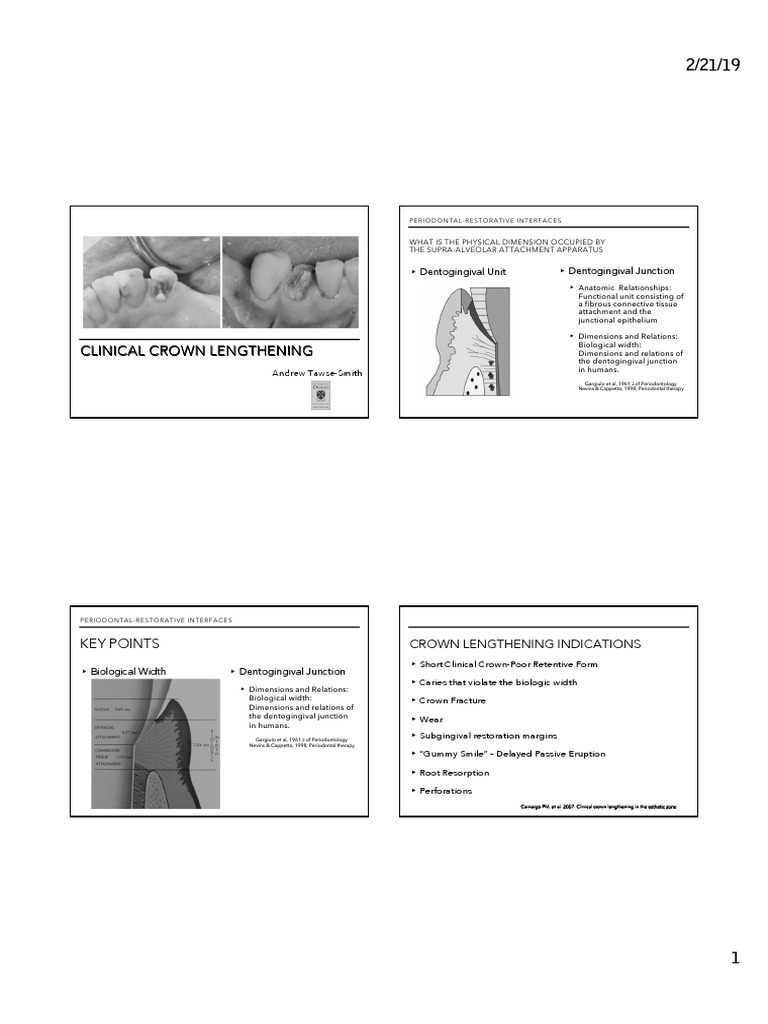 Crown Lengthening PDF Periodontology Medical Specialties
