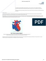 Patent Ductus Arteriosus: Patient Information