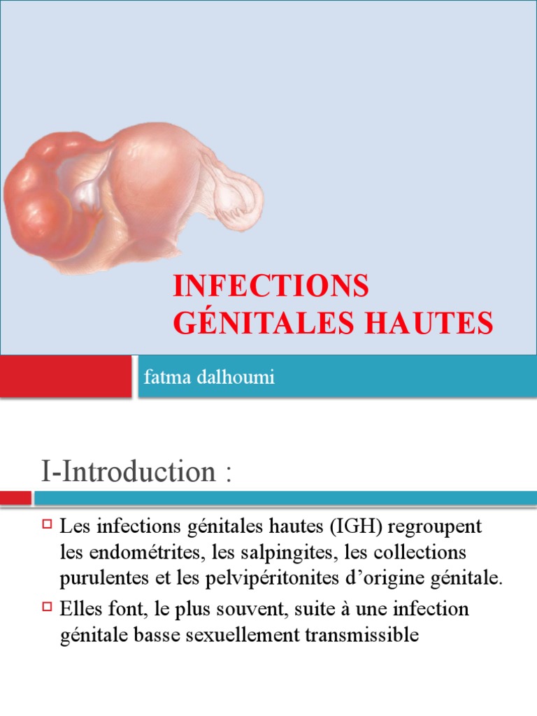 Infections Génitales Hautes chez la Femme PDF Gynécologie — free download