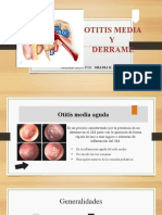 Otitis Media Aguda