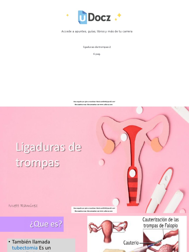 Ligaduras de Trompas 2 473649 Downloable 2208092 | PDF | Salud pública ...