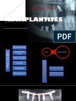 PDF 2022 23 Peri-Implantite