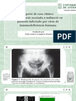 Caso Clinico Osteoporosis VIH Paula Aranguren