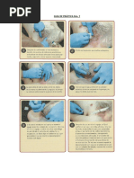 Colocación de Neumokit y Válvula Heimlich | PDF | Enfermedades y ...