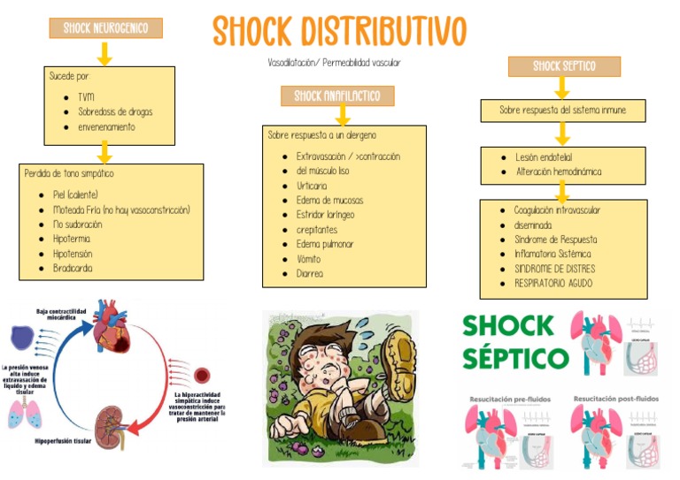 Mapa Shock Distributivo PDF