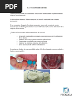 Ganchos Wipla en Prótesis Dentales | PDF | Ortodoncia | Boca