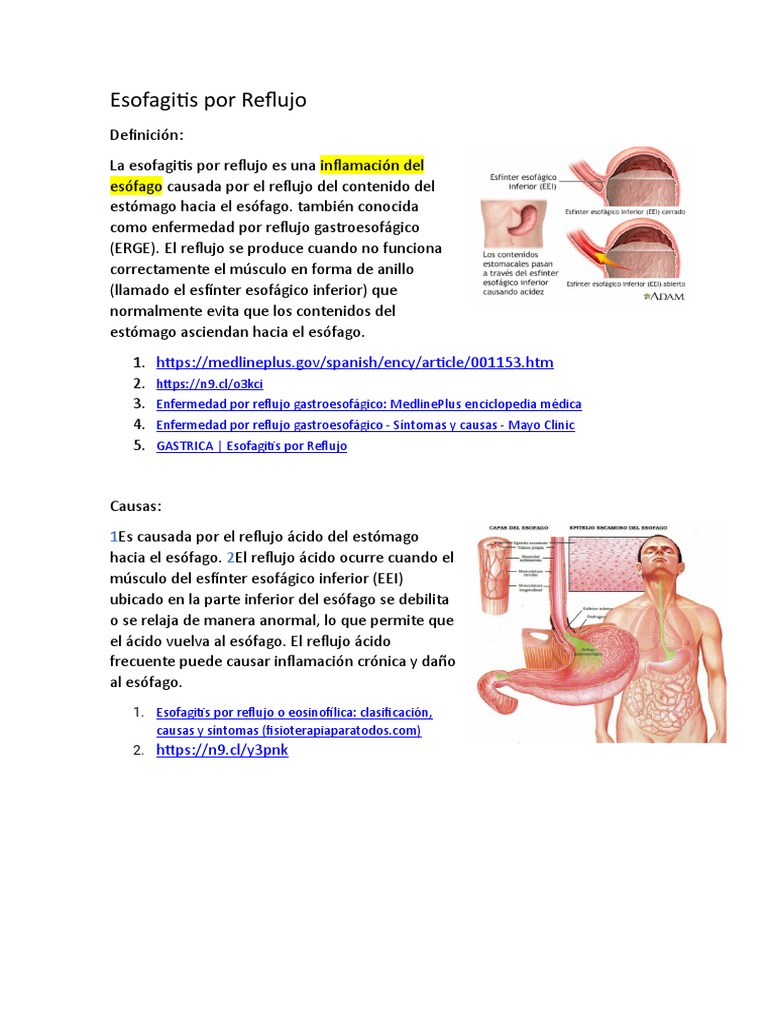 Esofagitis Por Reflujo | PDF | Relaciones personales, crianza y ...