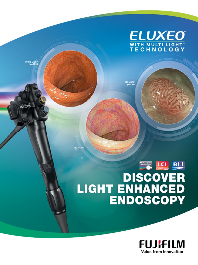 eluxeo-multi-light-technology | PDF | Colonoscopy | Telescopic Sight