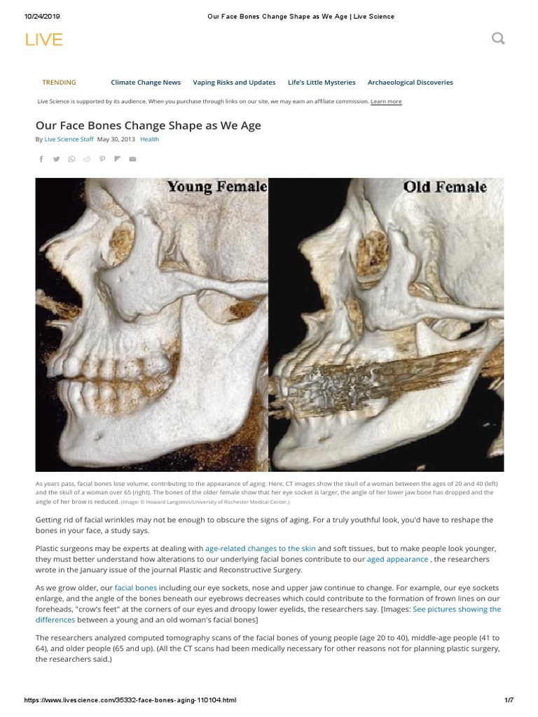 Our Face Bones Change Shape As We Age Live Science PDF Plastic