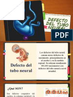 Defecto Del Tubo Neuronal