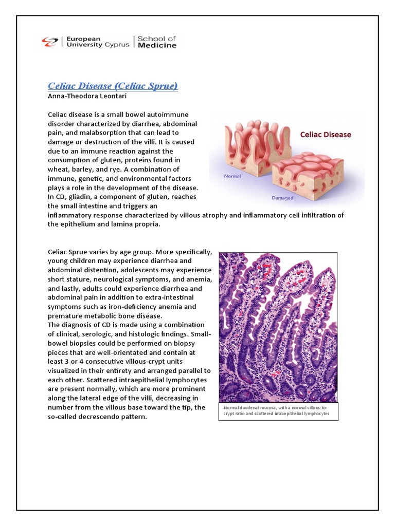 Celiac Disease | PDF | Coeliac Disease | Gluten