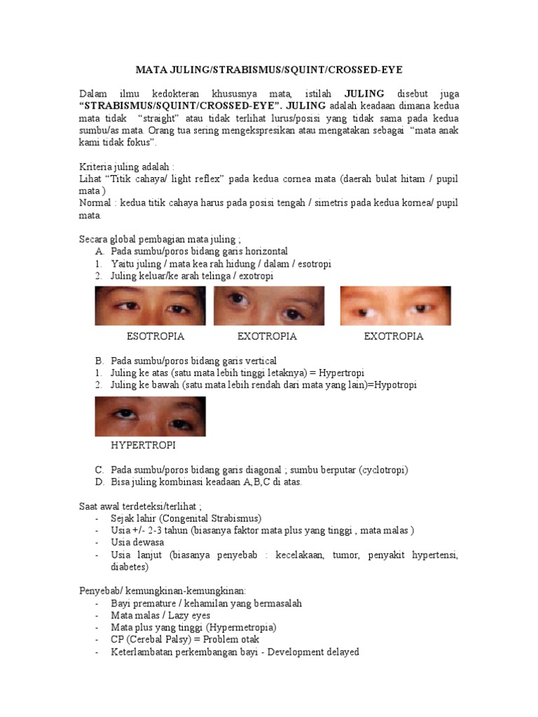 Penyebab dan Terapi Mata Juling | PDF | Pengembangan Diri | Kesehatan ...