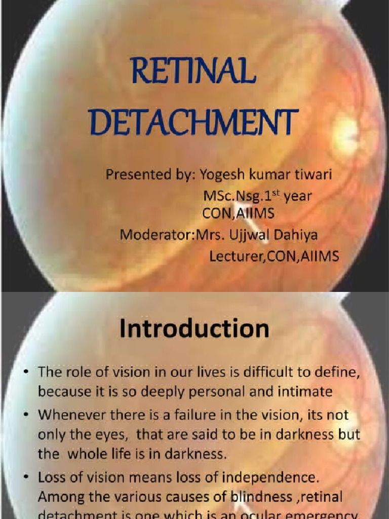 [Pdf] Traumatic Retinal Detachment. – ZVSP