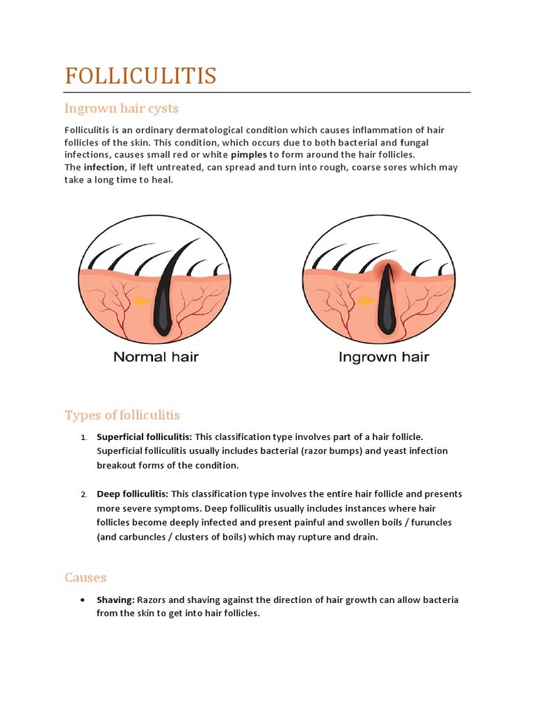3d Folliculitis Inflammation Of The Hair Follicle Infection On Transparent  Background, 3d Folliculitis Inflammation Of The Hair Follicle Infection, On  Transparent Background, Hair PNG Transparent Image and Clipart for Free  Download, image size:768x1024