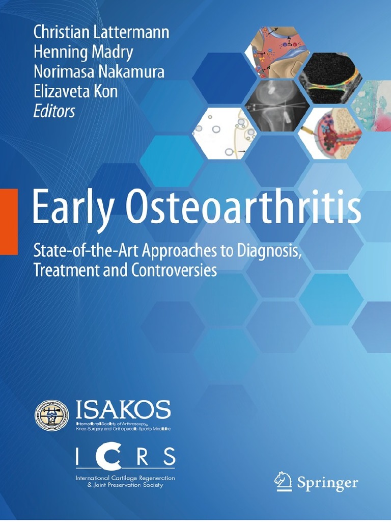 Early Osteoarthritis StateOfTheArt Approaches to Diagnosis