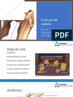 Fractura de Cadera