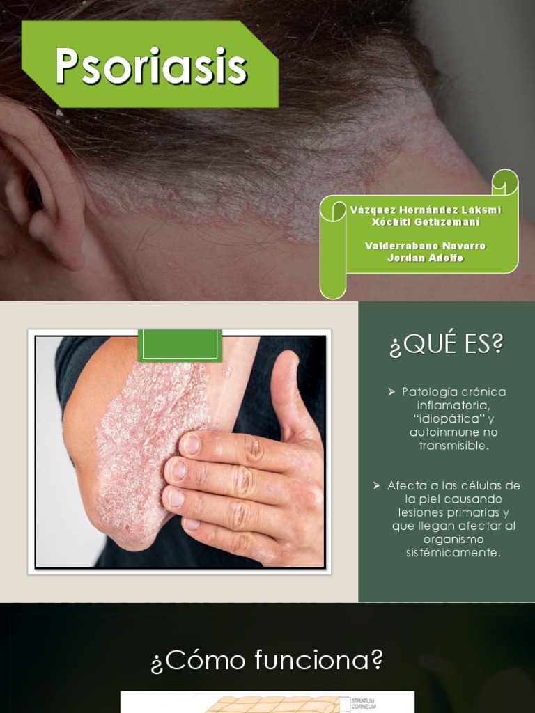 Psoriasis | PDF | Psoriasis | Causas de la muerte