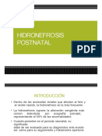 Hidronefrosis