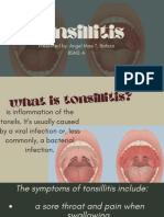 Tonsillitis and Epistaxis