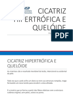 Cicatriz Hipertrófica E Quelóide: Prof Barbara Camargo