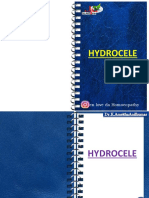 Hydrocele