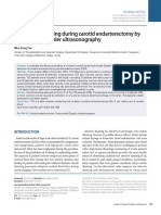 Cerebral Monitoring During Carotid Endarterectomy by Transcranial Doppler Ultrasonography