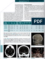 10.angiografia Por TC