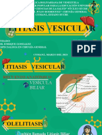 Litiasis Vesicular Completo