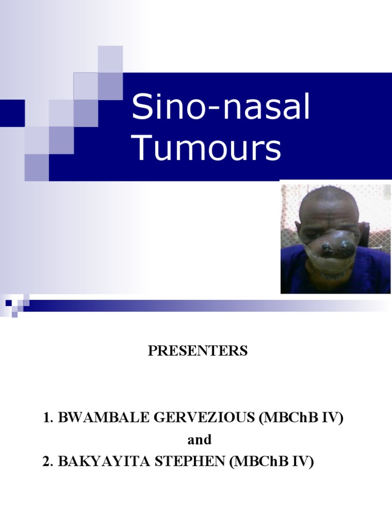 Understanding Ohngren's Line in Tumors | PDF | Human Nose | Skeletal System