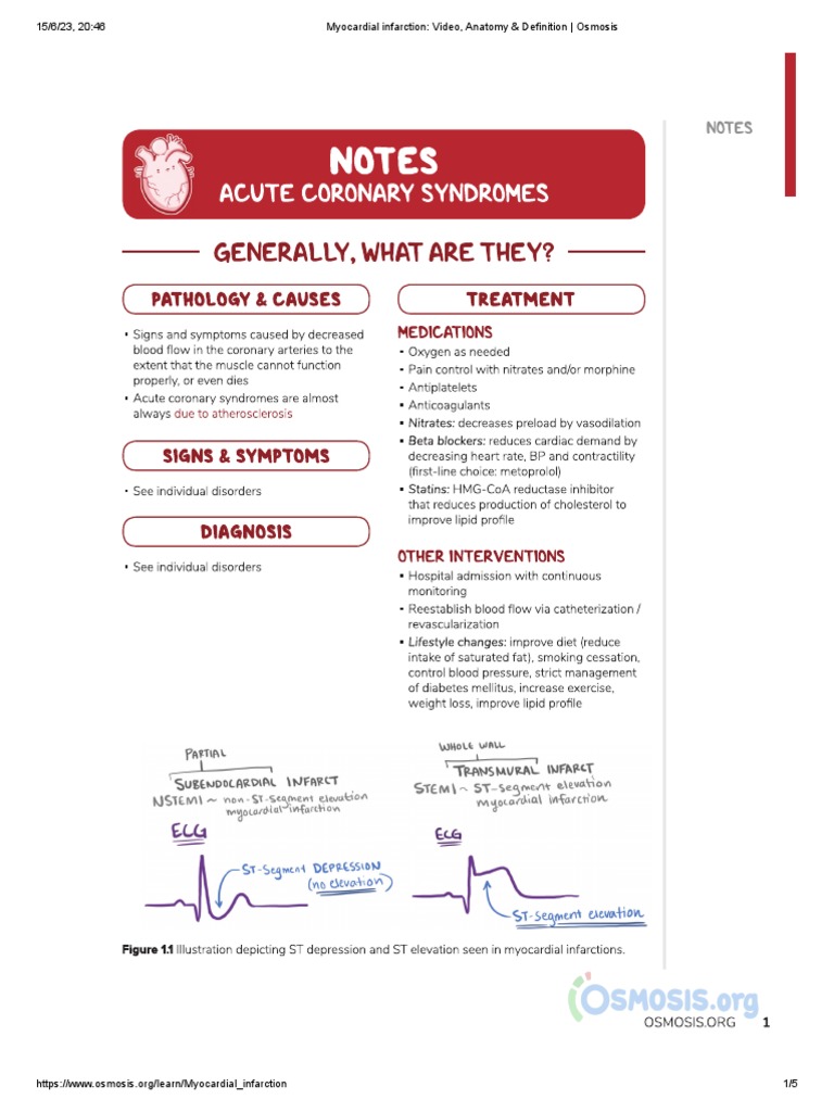 Myocardial Infarction Overview on Osmosis | PDF