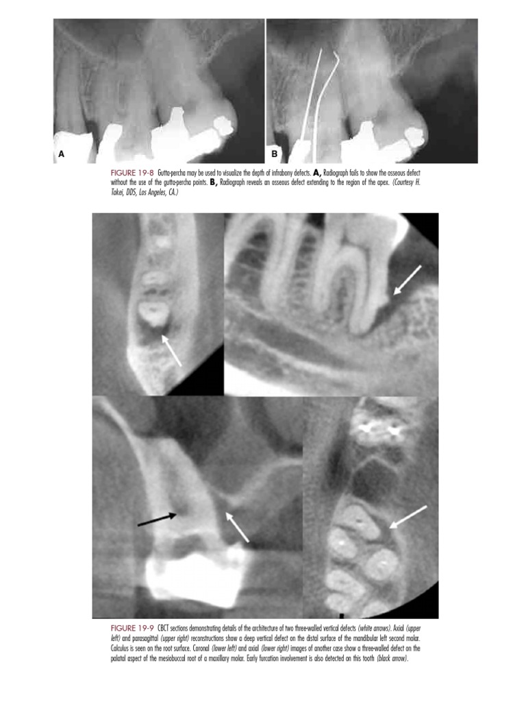 Oral Radiology Principles and Interpretation Part2 PDF