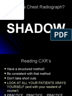 Chest X Ray CXR Basics Mbbs - PPT 111