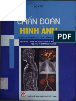 Chan Doan Hinh Anh 146784
