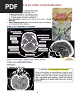 Tumores Selares y Supraselares | PDF | Glándula pituitaria | Anatomía ...