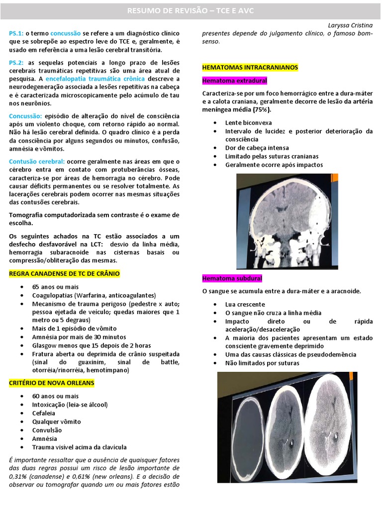 (Imagem) Resumo para A Prova - Tce e Avc | PDF | Traumatismo craniano | AVC